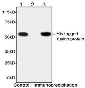 His Tag Antibody IP His Tag Antibody IP