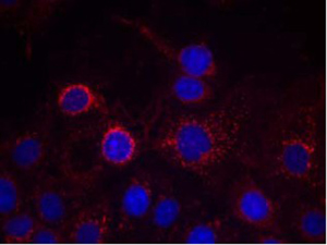 HER2 Antibody (Ab-1221,1222), pAb, Rabbit HER2 Antibody (Ab-1221,1222), pAb, Rabbit