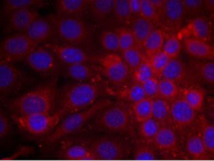 EGFR Antibody (Ab-1070), pAb, Rabbit EGFR Antibody (Ab-1070), pAb, Rabbit