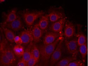 VEGFR2 Antibody (Ab-1175), pAb, Rabbit VEGFR2 Antibody (Ab-1175), pAb, Rabbit