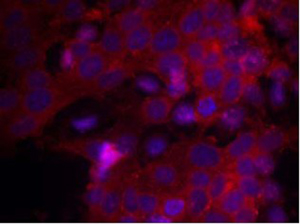 IGF-1R Antibody (Ab-1161), pAb, Rabbit