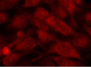Stathmin 1 Antibody (Ab-38), pAb, Rabbit Stathmin 1 Antibody (Ab-38), pAb, Rabbit