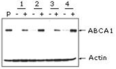 Mouse Anti ABCA1 (monoclonal) Western blot Mouse Anti ABCA1 (monoclonal) Western blot