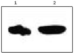 Mouse Anti ACAT1 (monoclonal) Western Blot