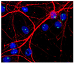 Mouse Anti-Fibrillarin Monoclonal Antibody Stain