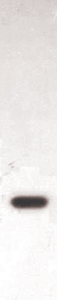 Goat Anti Human IL-8 (polyclonal) Western Blot Goat Anti Human IL-8 (polyclonal) Western Blot