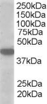 A549 lysate staining with anti-MCT2