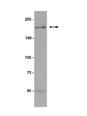 C2C12 lysate Western with Anti-Myosin Heavy Chain