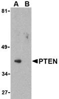 PC-3 lysates Western with Anti-PENT