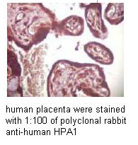 Rabbit Anti Human Heparanase 1 staining Rabbit Anti Human Heparanase 1 staining