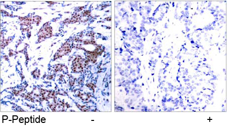 Rabbit Anti c-Jun (Phospho-Ser73) (polyclonal) Immunohistochemical analysis Rabbit Anti c-Jun (Phospho-Ser73) (polyclonal) Immunohistochemical analysis