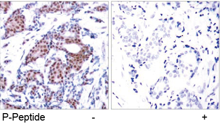 Rabbit Anti Elk-1(Phospho-Ser383) (polyclonal) Immunohistochemical analysis