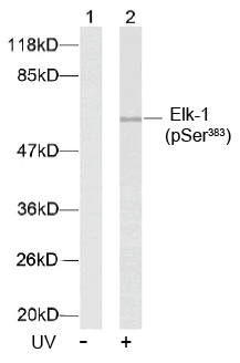 Rabbit Anti Elk-1(Phospho-Ser383) (polyclonal) Western blot