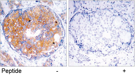 Rabbit Anti MEK-2(Ab-394)(polyclonal)Immunohistochemical analysis Rabbit Anti MEK-2(Ab-394)(polyclonal) Immunohistochemical analysis