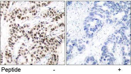 Rabbit Anti Myc (Ab-58)(polyclonal)Immunohistochemical analysis Rabbit Anti Myc (Ab-58) (polyclonal) Immunohistochemical analysis