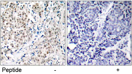 Rabbit Anti Anti Myc (Ab-358) (polyclonal) Immunohistochemical analysis Rabbit Anti Myc (Ab-358) (polyclonal) Immunohistochemical analysis