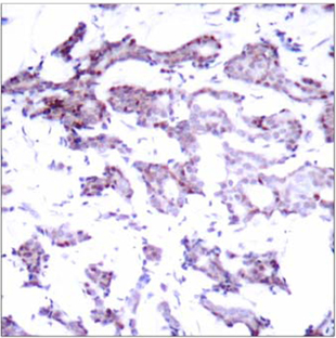 Rabbit Anti Elk-1(Ab-389)(polyclonal)Immunohistochemical analysis Rabbit Anti Elk-1(Ab-389)(polyclonal) Immunohistochemical analysis