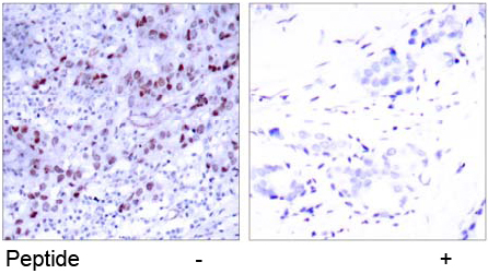 Rabbit Anti GATA-1 (Ab-142) (polyclonal)Immunohistochemical analysis Rabbit Anti GATA-1 (Ab-142) (polyclonal) Immunohistochemical analysis