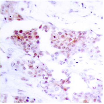 Rabbit Anti MEF2A (Ab-319) (polyclonal)Immunohistochemical analysis Rabbit Anti MEF2A (Ab-319) (polyclonal) Immunohistochemical analysis