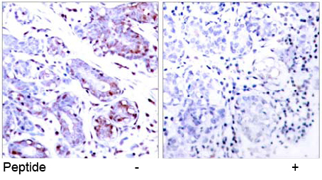 Rabbit Anti STAT1(Ab-701) (polyclonal)Immunohistochemical analysis Rabbit Anti STAT1(Ab-701) (polyclonal) Immunohistochemical analysis