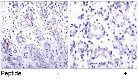 Rabbit Anti-STAT3 (Ab-727) Polyclonal Antibody IHC Rabbit Anti-STAT3 (Ab-727) Polyclonal Antibody IHC