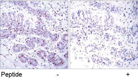 Rabbit Anti STAT4 (Ab-693) (polyclonal)Immunohistochemical analysis Rabbit Anti STAT4 (Ab-693) (polyclonal) Immunohistochemical analysis