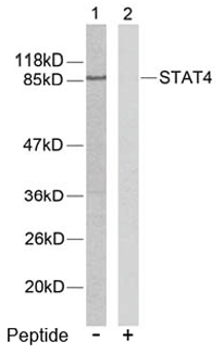 Rabbit Anti STAT4 (Ab-693) (polyclonal)Western blot analysis