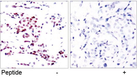 Rabbit Anti-STAT5A (Ab-780) Polyclonal Antibody immunohistochemical analysis