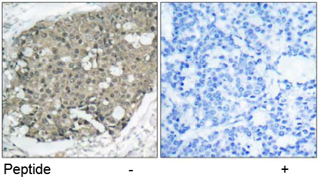 Rabbit Anti Akt (Ab-308)(polyclonal) Immunohistochemical analysis