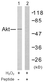 Rabbit Anti   Akt (Ab-308) (polyclonal)Western blot analysis