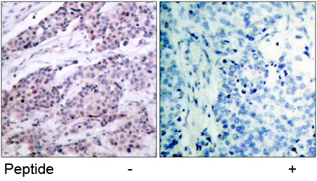 Rabbit Anti BCL-2 (Ab-56) (polyclonal)Immunohistochemical analysis Rabbit Anti BCL-2 (Ab-56) (polyclonal) Immunohistochemical analysis