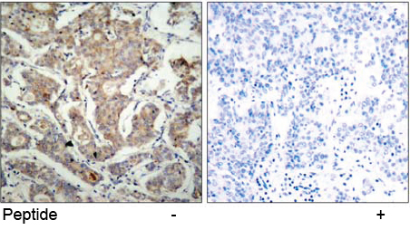 Rabbit Anti BAD (Ab-155) (polyclonal) Immunohistochemical analysis