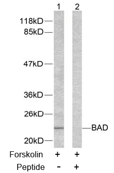 Rabbit Anti  BAD (Ab-155) (polyclonal)Western blot analysis