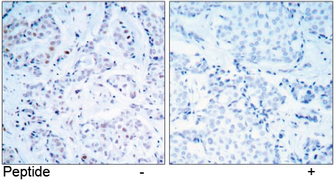 Rabbit Anti Estrogen Receptor-α (Ab-104) (polyclonal) Immunohistochemical analysis