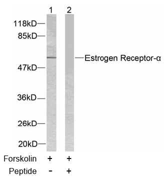 Rabbit Anti  Estrogen Receptor-α (Ab-104) (polyclonal)Western blot analysis