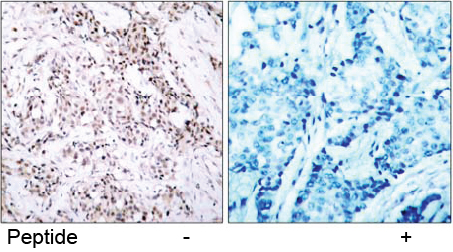 Rabbit Anti Estrogen Receptor-α (Ab-106) (polyclonal)Immunohistochemical analysis Rabbit Anti Estrogen Receptor-α (Ab-106)(polyclonal) Immunohistochemical analysis