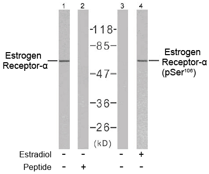 Rabbit Anti Estrogen Receptor-α (Ab-106) (polyclonal)Western blot analysis