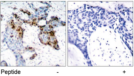Rabbit Anti-Estrogen Receptor-α (Ab-118) Polyclonal Antibody IHC