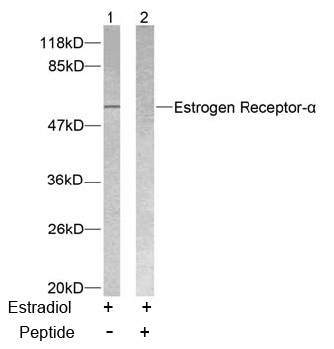 Rabbit Anti-Estrogen Receptor-α (Ab-118) Polyclonal Antibody WB