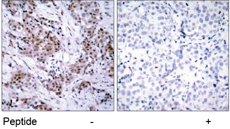 Rabbit Anti Estrogen Receptor-α (Ab-167) (polyclonal)Immunohistochemical analysis Rabbit Anti Estrogen Receptor-α (Ab-167) (polyclonal) Immunohistochemical analysis