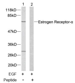 Rabbit Anti Estrogen Receptor-α (Ab-167) (polyclonal)Western blot analysis