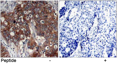 Rabbit Anti-HER2 (Ab-877) Polyclonal Antibody IHC Rabbit Anti-HER2 (Ab-877) Polyclonal Antibody IHC