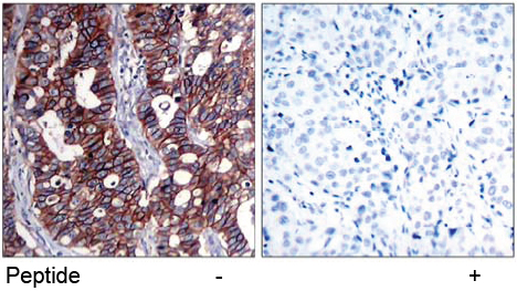 Rabbit Anti-HER2 (Ab-1221,1222) Polyclonal Antibody IHC