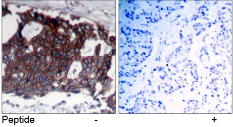 Rabbit Anti-HER2 (Ab-1248) Polyclonal Antibody IHC Rabbit Anti-HER2 (Ab-1248) Polyclonal Antibody IHC