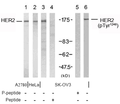 Rabbit Anti-HER2 (Ab-1248) Polyclonal Antibody WB Rabbit Anti-HER2 (Ab-1248) Polyclonal Antibody WB