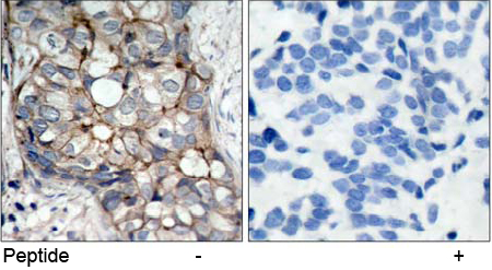 Rabbit Anti-EGFR (Ab-1070) Polyclonal Antibody IHC