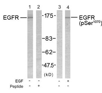 Rabbit Anti-EGFR (Ab-1070) Polyclonal Antibody WB