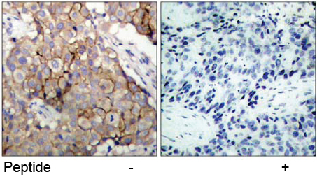 Rabbit Anti EGFR (Ab-1092) (polyclonal)Immunohistochemical analysis Rabbit Anti EGFR (Ab-1092) (polyclonal) Immunohistochemical analysis