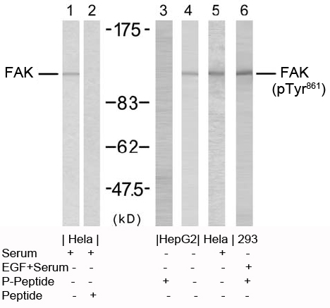 Rabbit Anti  FAK (Ab-861) (polyclonal)Western blot analysis