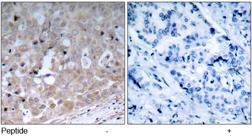 Rabbit Anti-VEGFR2 (Ab-1175) Polyclonal Antibody IHC